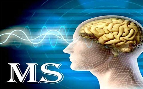 496 نفر مبتلا به ام ‌اس در کهگیلویه و بویراحمد