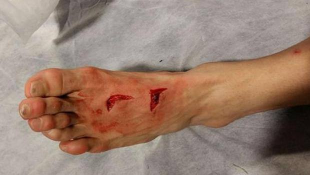 نمایش خشونت در فوتبال با انتشار یک عکس