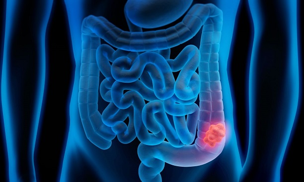 حال خوشِ مرغی که از قفس پرید( لطفا منتشر نشود)