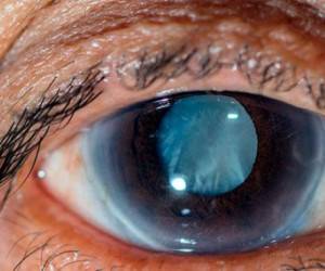 مواظب باشید،بینایی تان دزدیده نشود