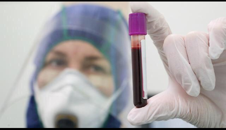 روش ها و داروهاي جديد درمان کرونا در جهان روش ها و داروهاي جديد درمان کرونا در جهان