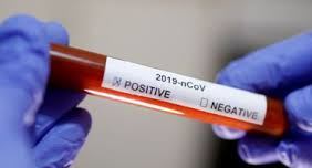 ثبت ۱۵ مورد مبتلای جدید به کووید ۱۹ در ایلام ثبت ۱۵ مورد مبتلای جدید به کووید ۱۹ در ایلام