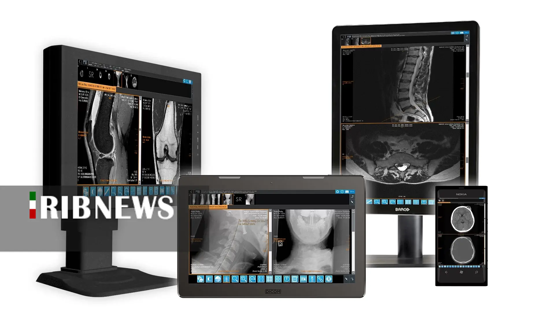 بهره برداری از سامانه پکس متمرکز در سازمان تامین اجتماعی خراسان شمالی بهره برداری از سامانه پکس متمرکز در سازمان تامین اجتماعی خراسان شمالی